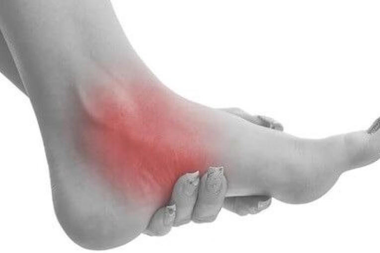 اسکن کف پا در غرب تهران